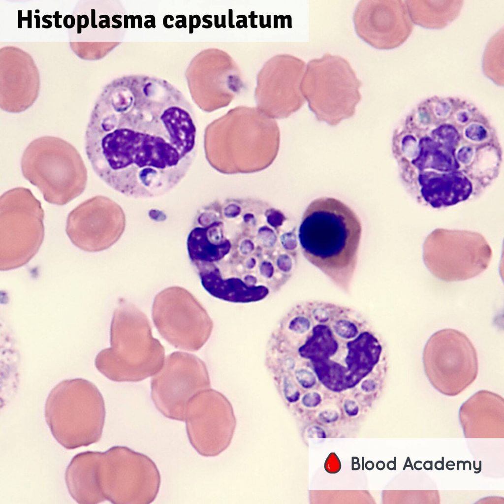 Histoplasma capsulatum