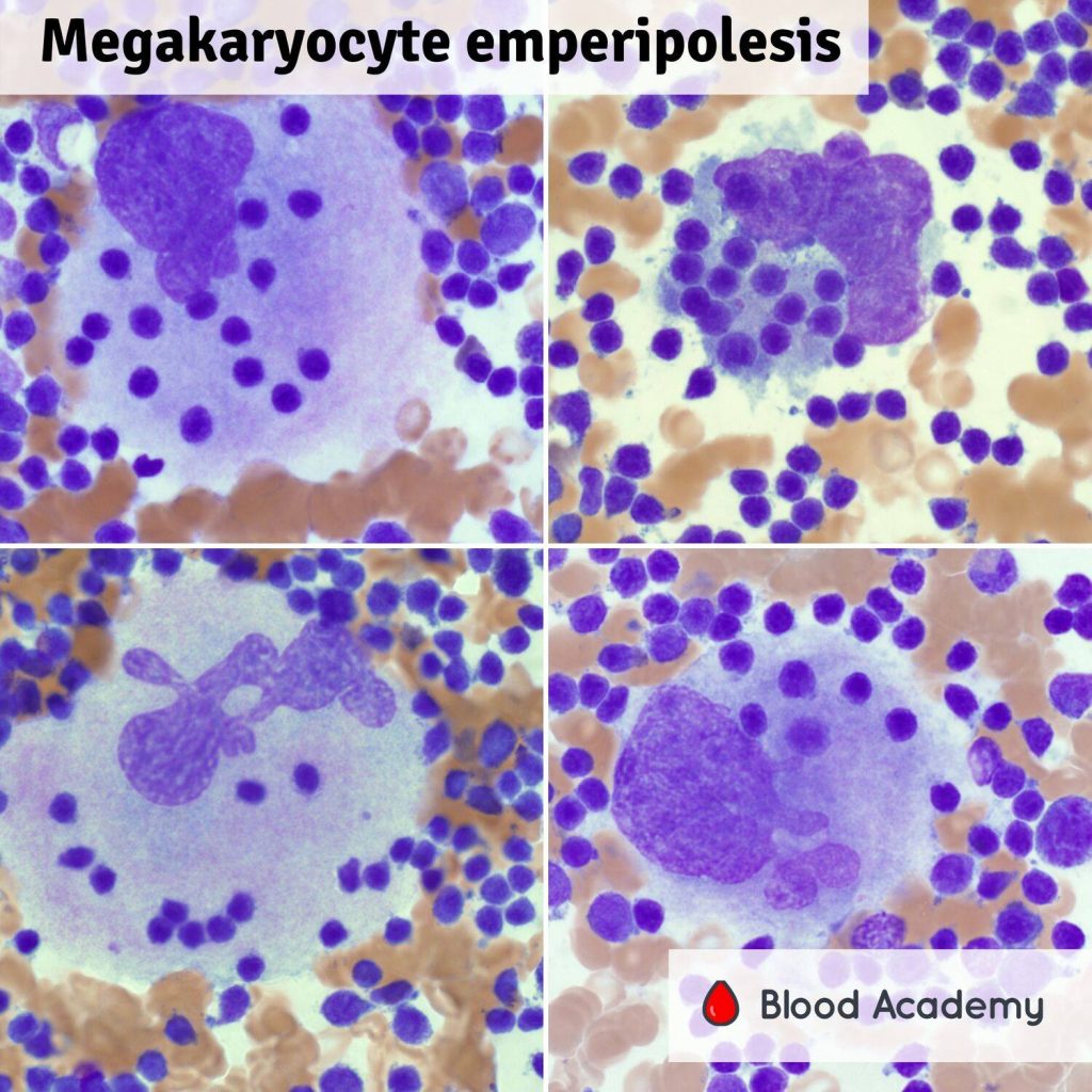 Megakaryocyte emperipolesis