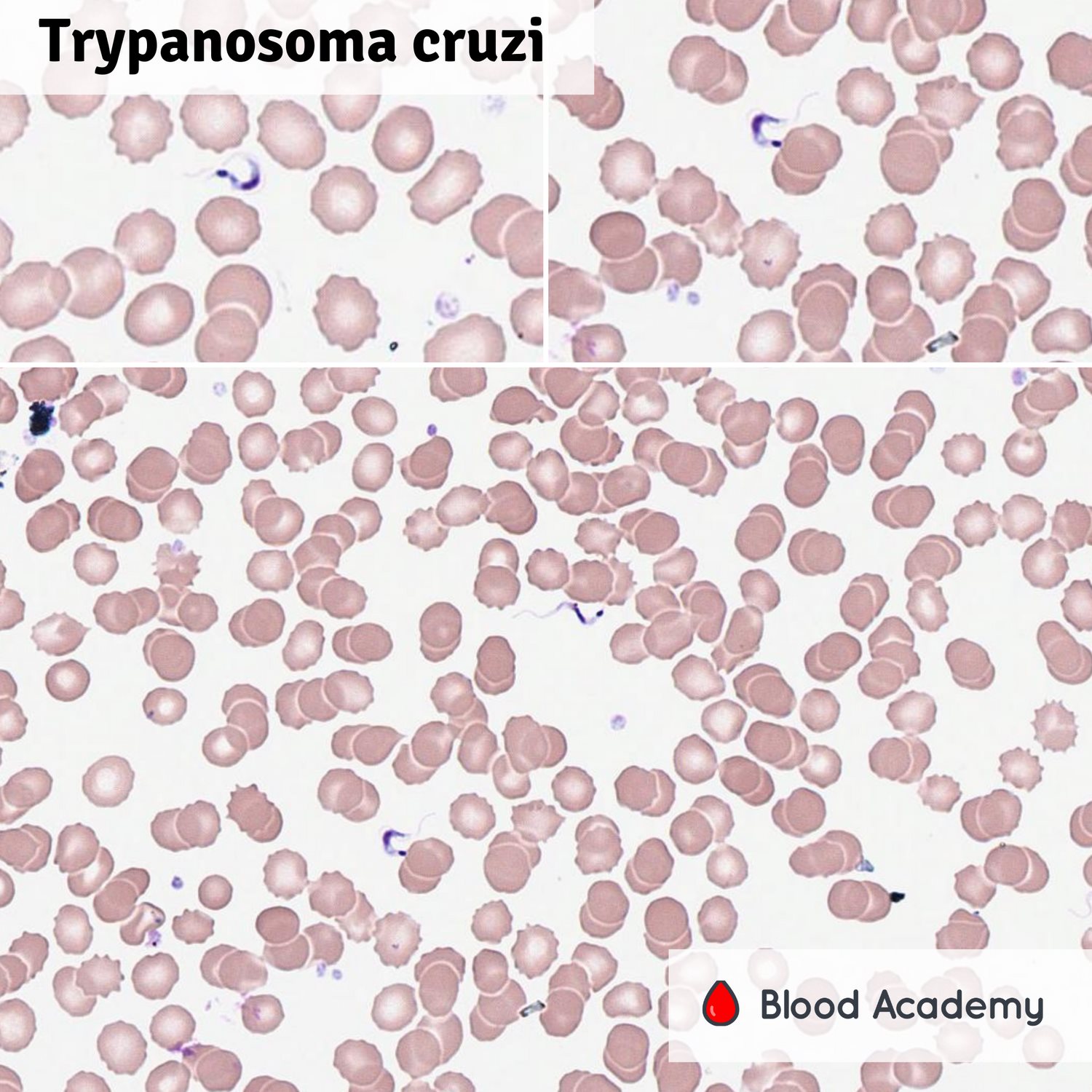 Trypanosoma cruzi