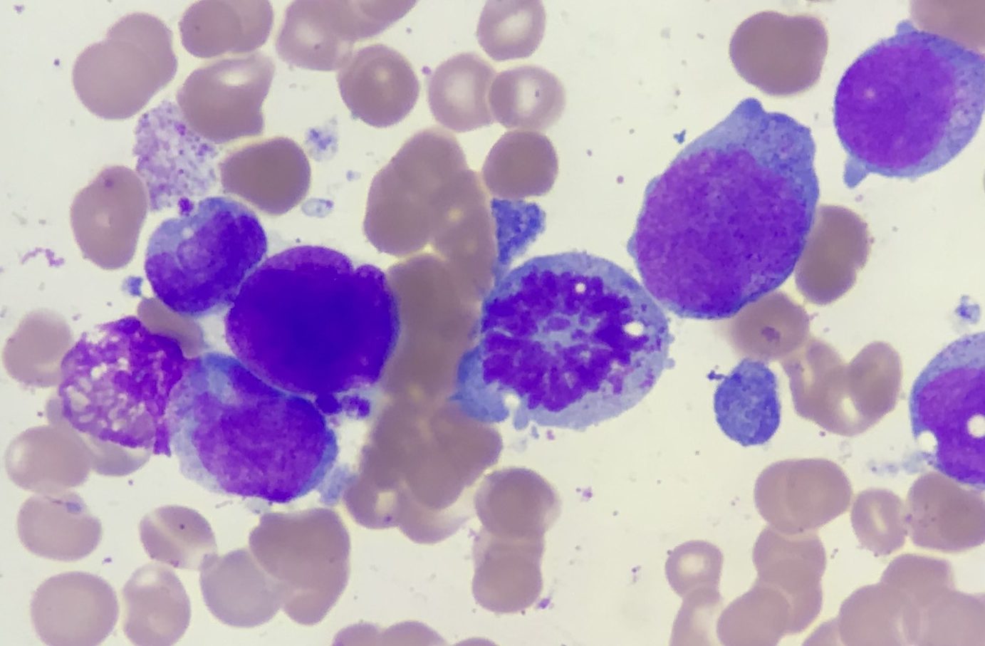 Essential Blood Cell Morphology
