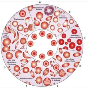 Essential Blood Cell Morphology Course