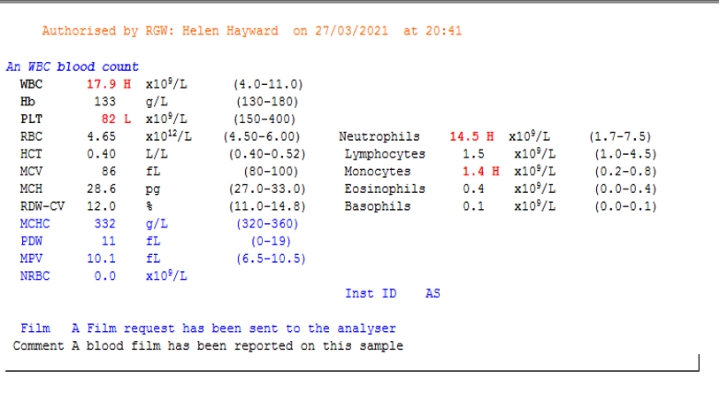 7.1i - D dimer Case Study 1