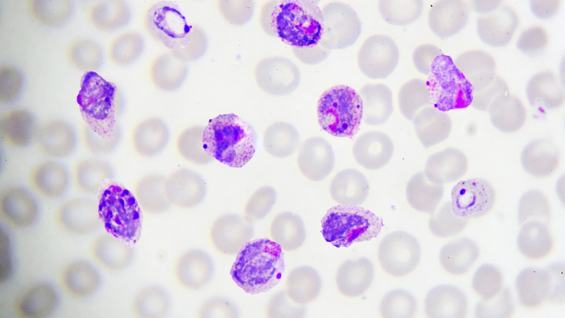 Essential Malaria Diagnostics Course