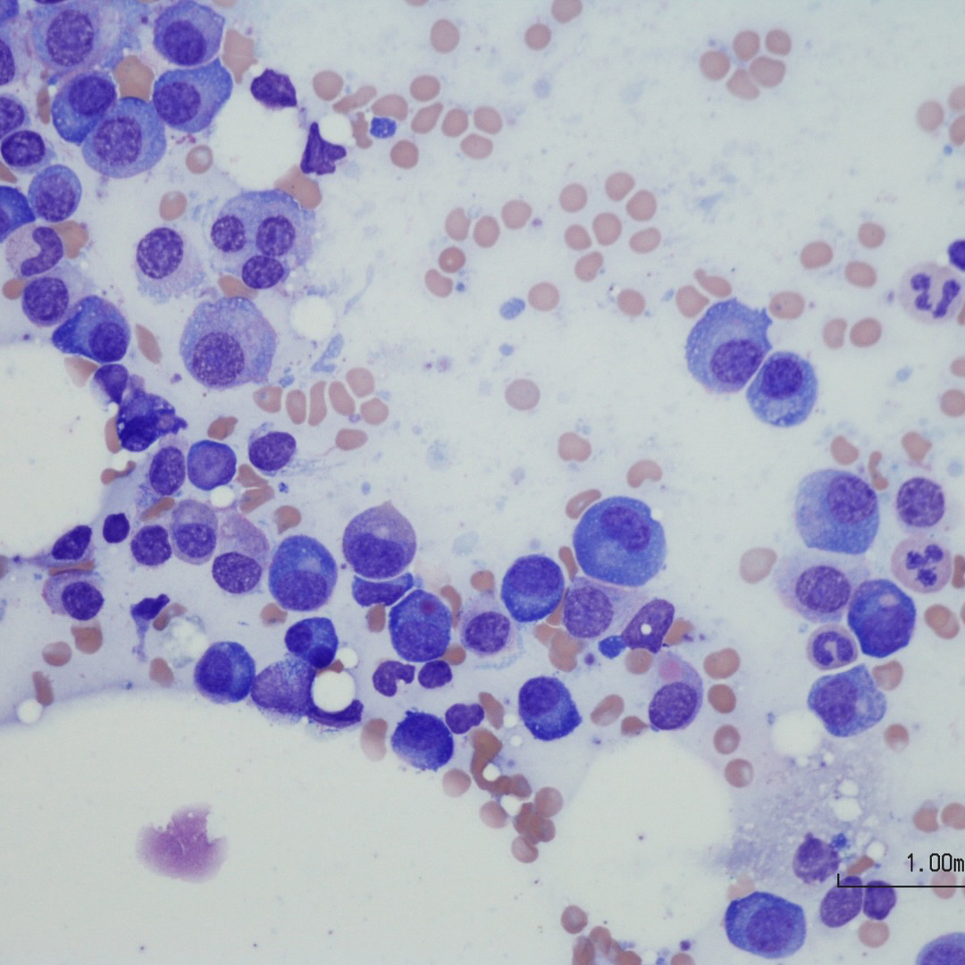 counting-plasma-cells