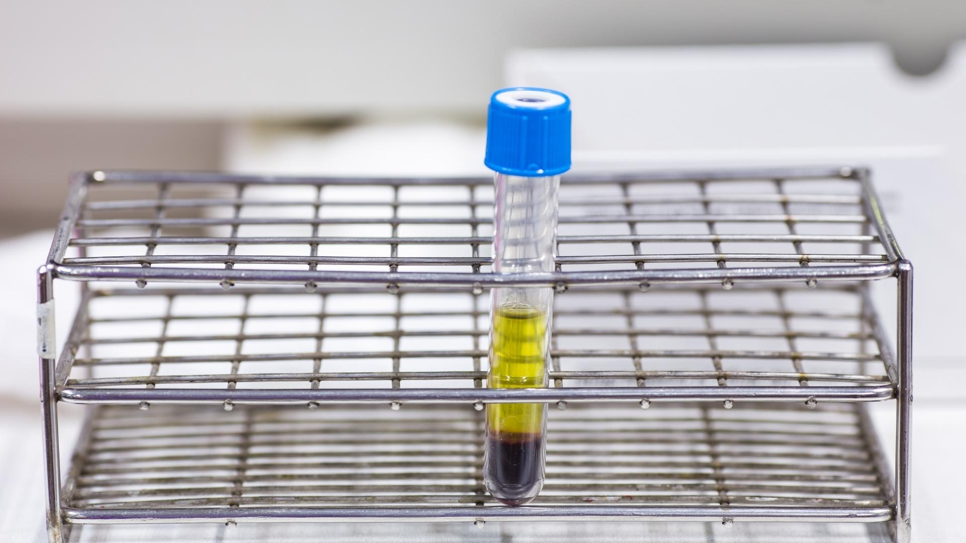Advanced Haemostasis and Thrombosis Course – September 2023