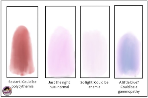 The Blood Smear