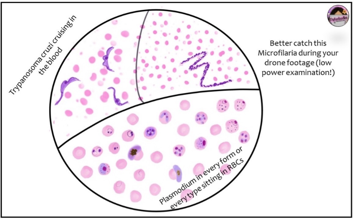 The Blood Smear