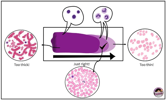 The Blood Smear