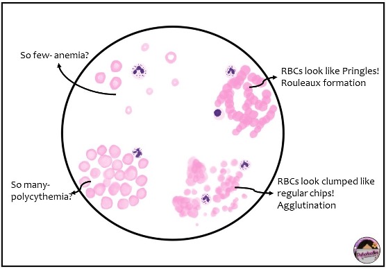 The Blood Smear