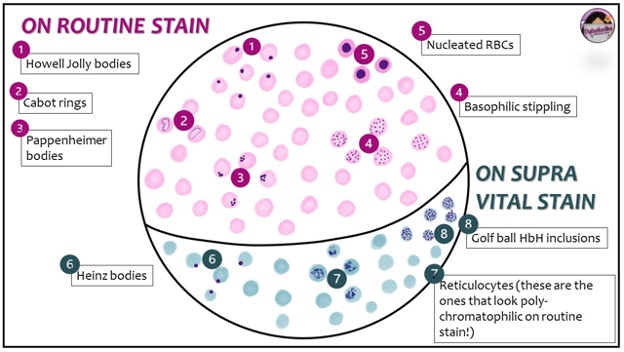 The Blood Smear