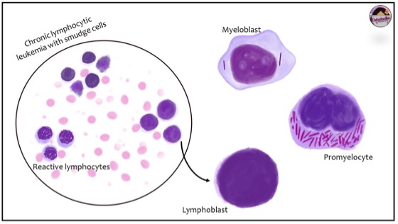 The Blood Smear