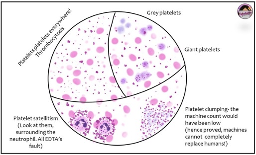 The Blood Smear